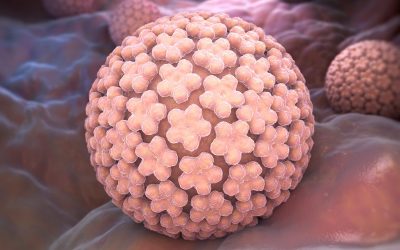 HPV – genotipare