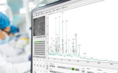 Un nou aparat care procesează peste 300 de probe pe oră la Laboratorul Ramus