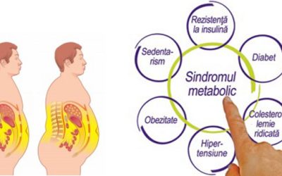 Diagnosticul si managementul sindromului metabolic